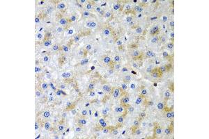 Immunohistochemistry of paraffin-embedded human liver injury using SRGN antibody (ABIN5974179) at dilution of 1/200 (40x lens). (SRGN 抗体)