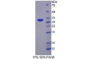 SDS-PAGE (SDS) image for Protein tyrosine Phosphatase, Receptor Type, N Polypeptide 2 (PTPRN2) protein (ABIN6118575)