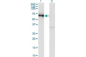Western Blot analysis of GOLM1 expression in transfected 293T cell line by GOLM1 monoclonal antibody (M06A), clone 5B10. (GOLM1 抗体  (AA 302-401))