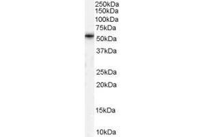 Western Blotting (WB) image for anti-Chromosome 20 Open Reading Frame 96 (C20ORF96) (N-Term) antibody (ABIN2791311) (C20ORF96 抗体  (N-Term))