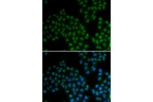 Immunofluorescence analysis of MCF7 cell using SOX2 antibody.