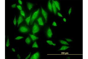 Immunofluorescence of purified MaxPab antibody to RPL29 on HeLa cell. (RPL29 抗体  (AA 1-157))