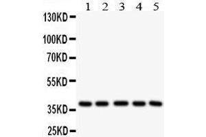 Anti- LOX1 antibody, Western blotting All lanes: Anti LOX1  at 0. (OLR1 抗体  (Middle Region))