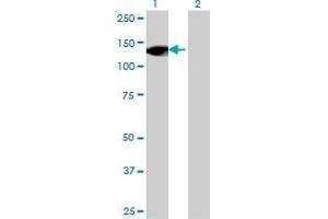 Western Blotting (WB) image for anti-Ring Finger Protein 40, E3 Ubiquitin Protein Ligase (RNF40) (AA 102-200) antibody (ABIN523241)