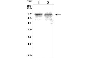Western blot analysis of TLR1 using anti-TLR1 antibody (ABIN7602194).