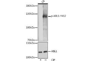 Western blot analysis of extracts of C6 cells, using Phospho-c-Abl-Y412 pAb (ABIN7265966) at 1:1000 dilution or  antibody (ABIN3020871, ABIN3020872, ABIN3020873 and ABIN6213767). (ABL1 抗体  (pTyr412))