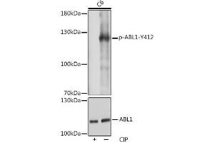 Western blot analysis of extracts of C6 cells, using Phospho-c-Abl-Y412 pAb (ABIN7265966) at 1:1000 dilution or  antibody (ABIN3020871, ABIN3020872, ABIN3020873 and ABIN6213767).