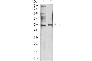 Western Blotting (WB) image for anti-Serotonin Receptor 3B (HTR3B) (AA 23-150) antibody (ABIN5611118)