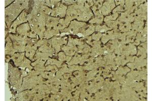 ABIN6276811 at 1/100 staining Mouse brain tissue by IHC-P. (Paired Box 3 抗体  (Internal Region))