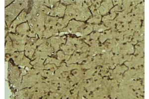 ABIN6276811 at 1/100 staining Mouse brain tissue by IHC-P.