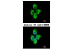 ICC/IF Image Immunofluorescence analysis of methanol-fixed A431, using MMP8, antibody at 1:500 dilution. (MMP8 抗体)