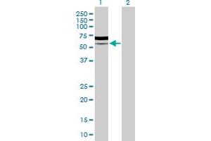 Western Blot analysis of PIK3R5 expression in transfected 293T cell line by PIK3R5 MaxPab polyclonal antibody. (PIK3R5 抗体  (AA 1-494))