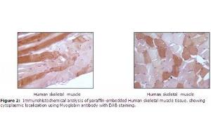 Image no. 1 for anti-Myoglobin (MB) antibody (ABIN207623) (Myoglobin 抗体)
