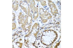 Immunohistochemistry of paraffin-embedded human stomach using NRG4 antibody (ABIN3016309, ABIN3016310, ABIN3016311 and ABIN6219713) at dilution of 1:100 (40x lens). (Neuregulin 4 抗体  (AA 1-115))