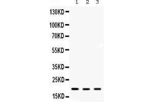 Western blot analysis of ARF6 expression in rat kidney extract ( Lane 1), mouse kidney extract ( Lane 2) and MCF-7 whole cell lysates ( Lane 3).
