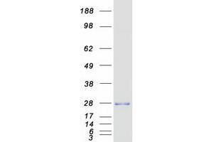Validation with Western Blot