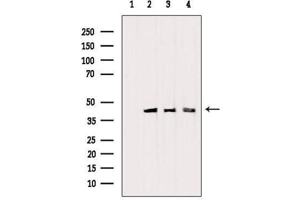 PDHA1 抗体  (C-Term)