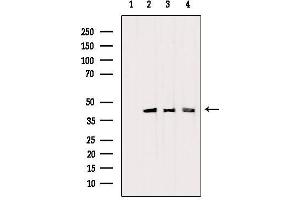 Western blot analysis of extracts from various samples, using PDHA1 Antibody. (PDHA1 抗体  (C-Term))