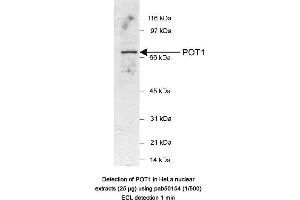 Image no. 1 for anti-Protection of Telomeres 1 (POT1) (AA 200-300) antibody (ABIN363463) (POT1 抗体  (AA 200-300))
