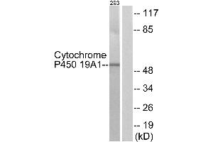 Immunohistochemistry analysis of paraffin-embedded human brain tissue using Cytochrome P450 19A1 antibody. (Aromatase 抗体)