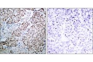 Immunohistochemistry (IHC) image for anti-Tumor Protein P53 (TP53) (AA 281-330), (pSer315) antibody (ABIN1531935)