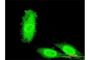 Immunofluorescence of monoclonal antibody to IRAK3 on HeLa cell. (IRAK3 抗体  (AA 497-596))