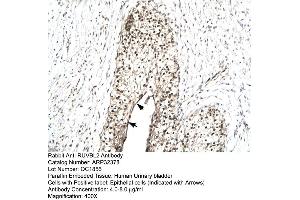 Human urinary bladder (RUVBL2 抗体  (N-Term))