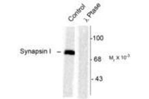 Image no. 1 for anti-Synapsin I (SYN1) (pSer603) antibody (ABIN227585) (SYN1 抗体  (pSer603))