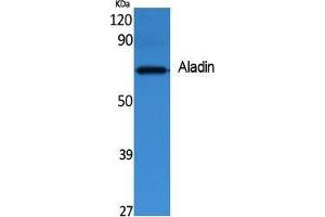 Western Blotting (WB) image for anti-Achalasia, Adrenocortical Insufficiency, Alacrimia (AAAS) (C-Term) antibody (ABIN3187610) (Adracalin 抗体  (C-Term))
