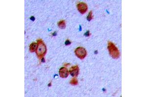 Immunohistochemical analysis of Ryanodine Receptor 2 (pS2808) staining in human brain formalin fixed paraffin embedded tissue section. (RYR2 抗体  (pSer2808))