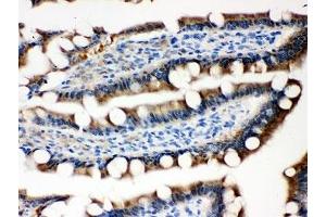 Immunohistochemistry (IHC) image for anti-Ovalbumin (OVA) (AA 1-350) antibody (ABIN3032105)