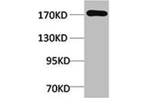 Western blot analysis of Rat Liver Tissue using EPG5 Polyclonal Antibody. (EPG5 抗体)