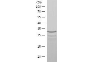 Western Blotting (WB) image for Acetyl LDL Receptor (SCARF1) (AA 623-830) protein (His tag) (ABIN7121638) (SCARF1 Protein (AA 623-830) (His tag))