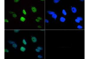 Fluorescence Microscopy (FM) image for anti-Histone 3 (H3) (3meLys18) antibody (ABIN5706756)