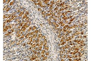 ABIN6263527 and ABIN6279597 at 1/100 staining rat stomach tissue by IHC-P. (NBPF6 抗体  (C-Term))