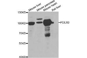 Western blot analysis of extracts of various cell lines, using PDE6B antibody. (PDE6B 抗体)