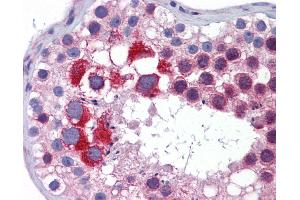 Anti-MTL5 antibody IHC of human testis. (MTL5 抗体  (AA 51-100))