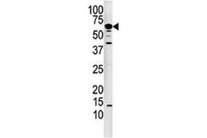 Western blot analysis of Calcineurin antibody and mouse kidney tissue lysate. (CAN 抗体  (AA 21-51))