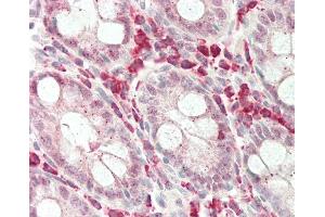 Immunohistochemistry (Paraffin-embedded Sections) (IHC (p)) image for anti-Killer Cell Lectin-Like Receptor Subfamily C, Member 2 (KLRC2) (AA 1-30), (N-Term) antibody (ABIN652570)