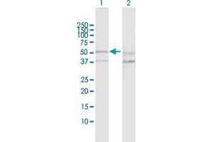 Western Blot analysis of SESN2 expression in transfected 293T cell line by SESN2 MaxPab polyclonal antibody. (Sestrin 2 抗体  (AA 1-480))