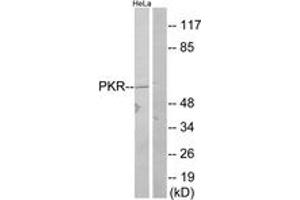 Western blot analysis of extracts from HeLa, using PKR (Ab-446) Antibody. (EIF2AK2 抗体  (AA 413-462))