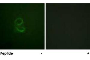 Immunofluorescence analysis of A-549 cells, using IL4R polyclonal antibody . (IL4 Receptor 抗体)