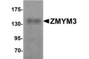 Western blot analysis of ZMYM3 in human brain tissue lysate with ZMYM3 antibody at 1 μg/ml. (ZMYM3 抗体  (N-Term))