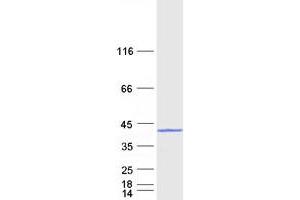 Western Blotting (WB) image for Ankyrin Repeat and SOCS Box Containing 9 (ASB9) (Transcript Variant 1) protein (Myc-DYKDDDDK Tag) (ABIN2714972)