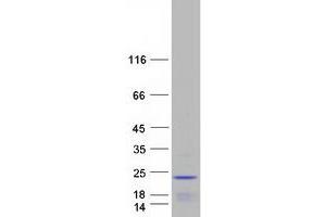 Western Blotting (WB) image for Ribonuclease P/MRP 25 Subunit-Like (RPP25L) (Transcript Variant 2) protein (Myc-DYKDDDDK Tag) (ABIN2712980)