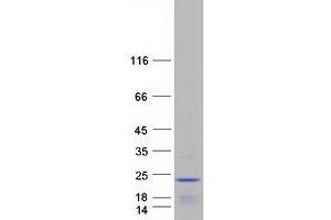 Validation with Western Blot (RPP25L Protein (Transcript Variant 2) (Myc-DYKDDDDK Tag))