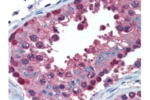 Testis, Human: Formalin-Fixed, Paraffin-Embedded (FFPE) (PDIA4 抗体  (AA 623-638))
