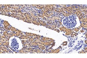 Detection of MAPK14 in Porcine Kidney Tissue using Polyclonal Antibody to Mitogen Activated Protein Kinase 14 (MAPK14) (MAPK14 抗体  (AA 19-279))