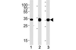 CCND1 antibody western blot analysis in (1) human A431, (2) mouse L929 and (3) rat C6 lysate.