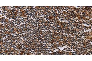 Immunohistochemistry of paraffin-embedded Human tonsil using MAGEA3 Polyclonal Antibody at dilution of 1:50 (MAGEA3 抗体)